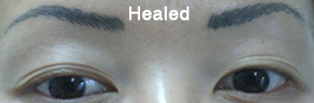 Permanent Eyebrows in Eau Claire, WI