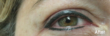 Permanent Eyeliner in Eau Claire, WI