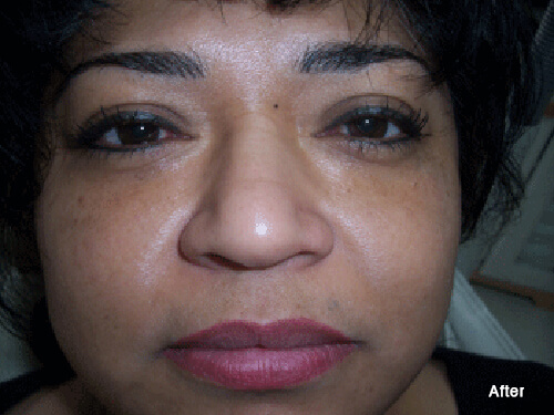 Permanent Eyeliner, Eyebrows and Lips