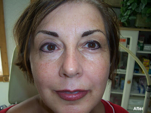 Permanent Eyeliner, Eyebrows and Lips