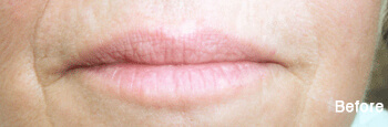 Permanent Lipstick in Eau Claire, WI