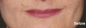 Permanent Lipstick in Eau Claire, WI
