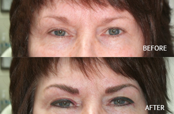   Permanent Eyeliner in Eau Claire, WI