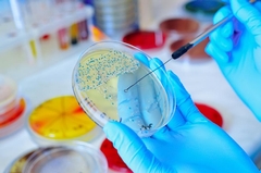 What Temperature Does Mold Die At? Facts Explained