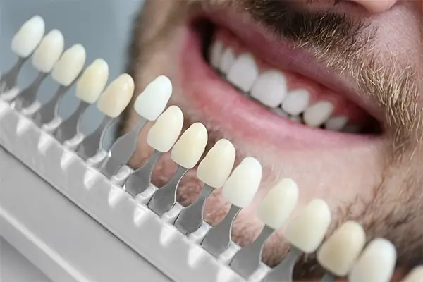 Cosmetic Dentistry