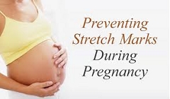 Preventing and Treating Stretch Marks