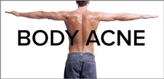 6 ways to prevent body acne
