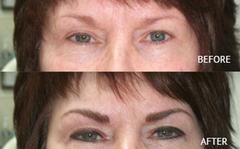 LOOK 10 YEARS YOUNGER WITHOUT SURGERY!!!