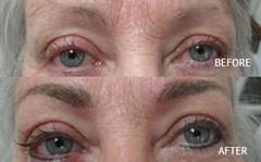 LOOK 10 YEARS YOUNGER WITHOUT SURGERY!!!