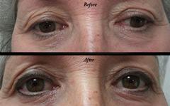 Permanent Eyebrows near Eau Claire, Wisconsin